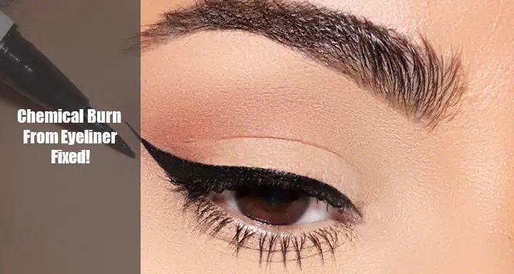 Chemical Burn from Eyeliner- 6 Reasons and Treatments