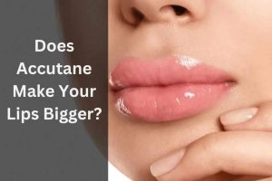 Does Accutane Make Your Lips Bigger